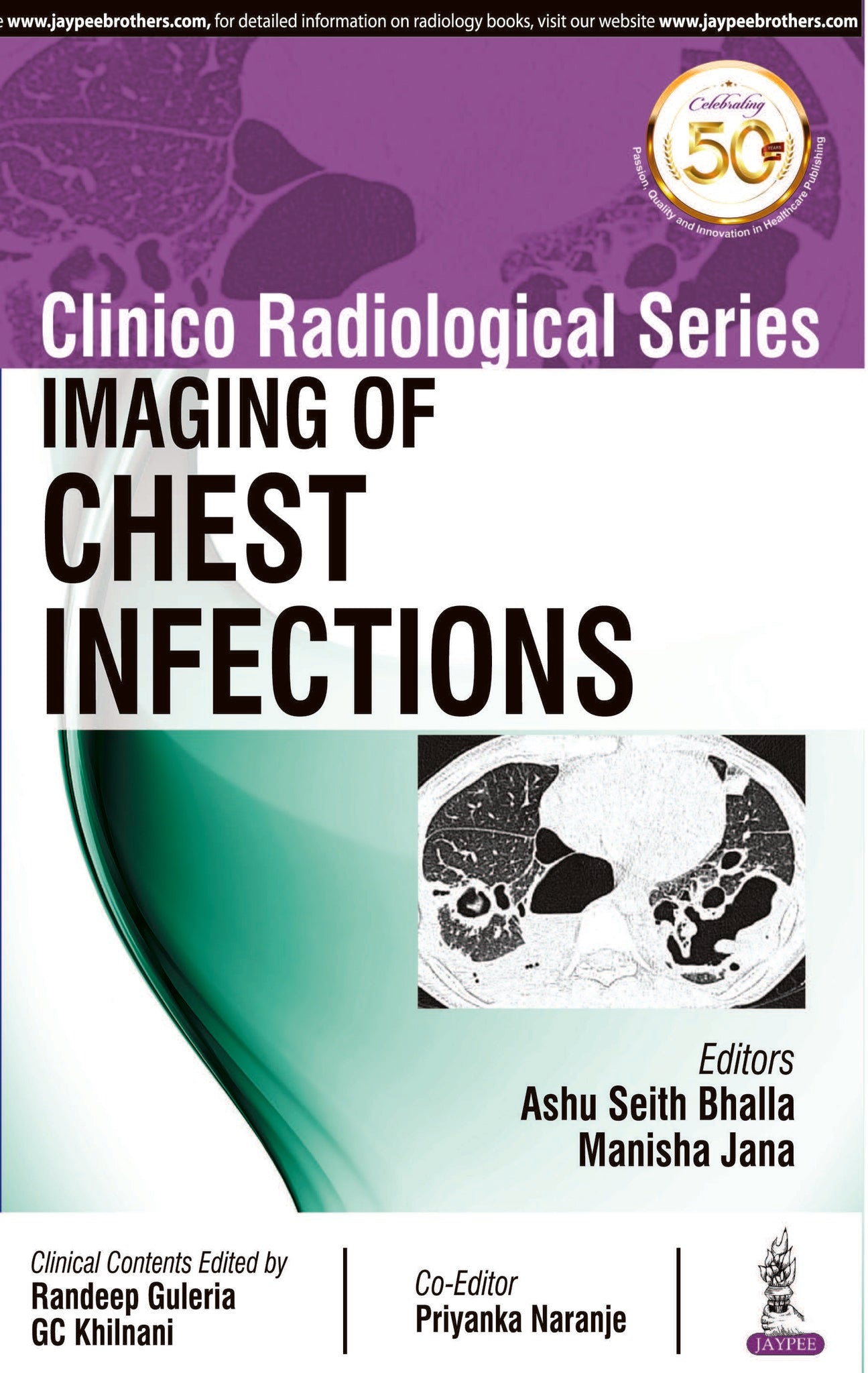 Clinico Radiological Series: Imaging of Chest Infections