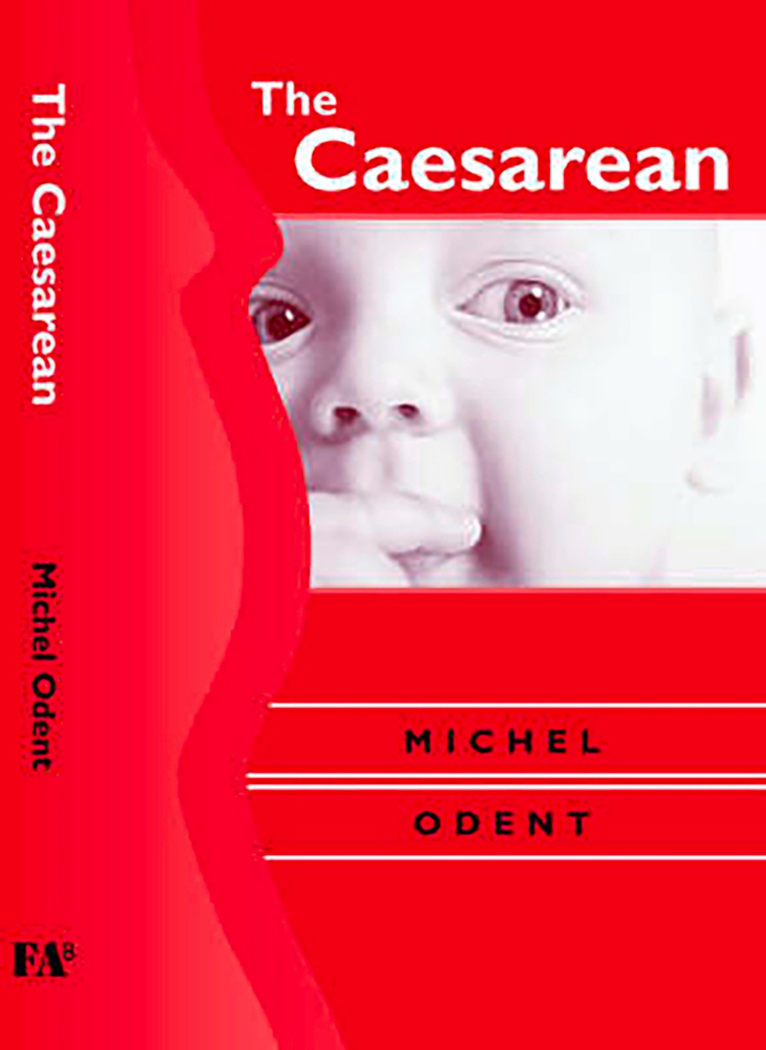 The Caesarean