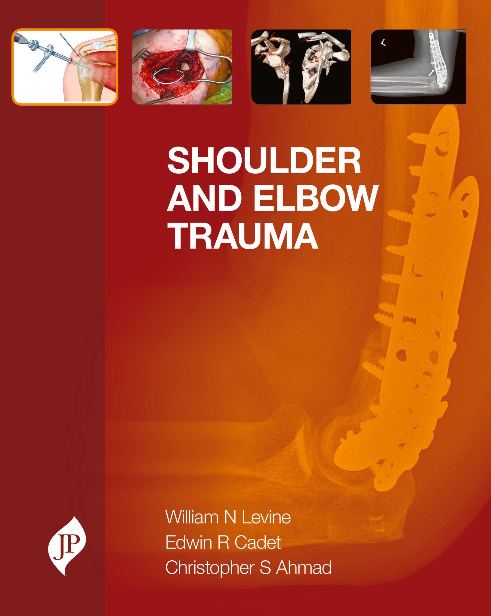 Shoulder and Elbow Trauma