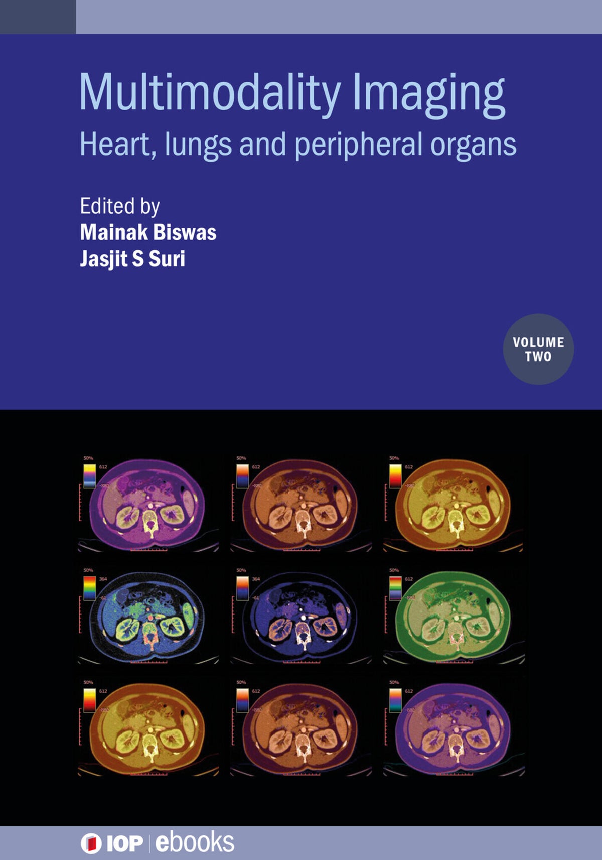 Cover image for Multimodality Imaging, Volume 2 ISBN 9780750323536