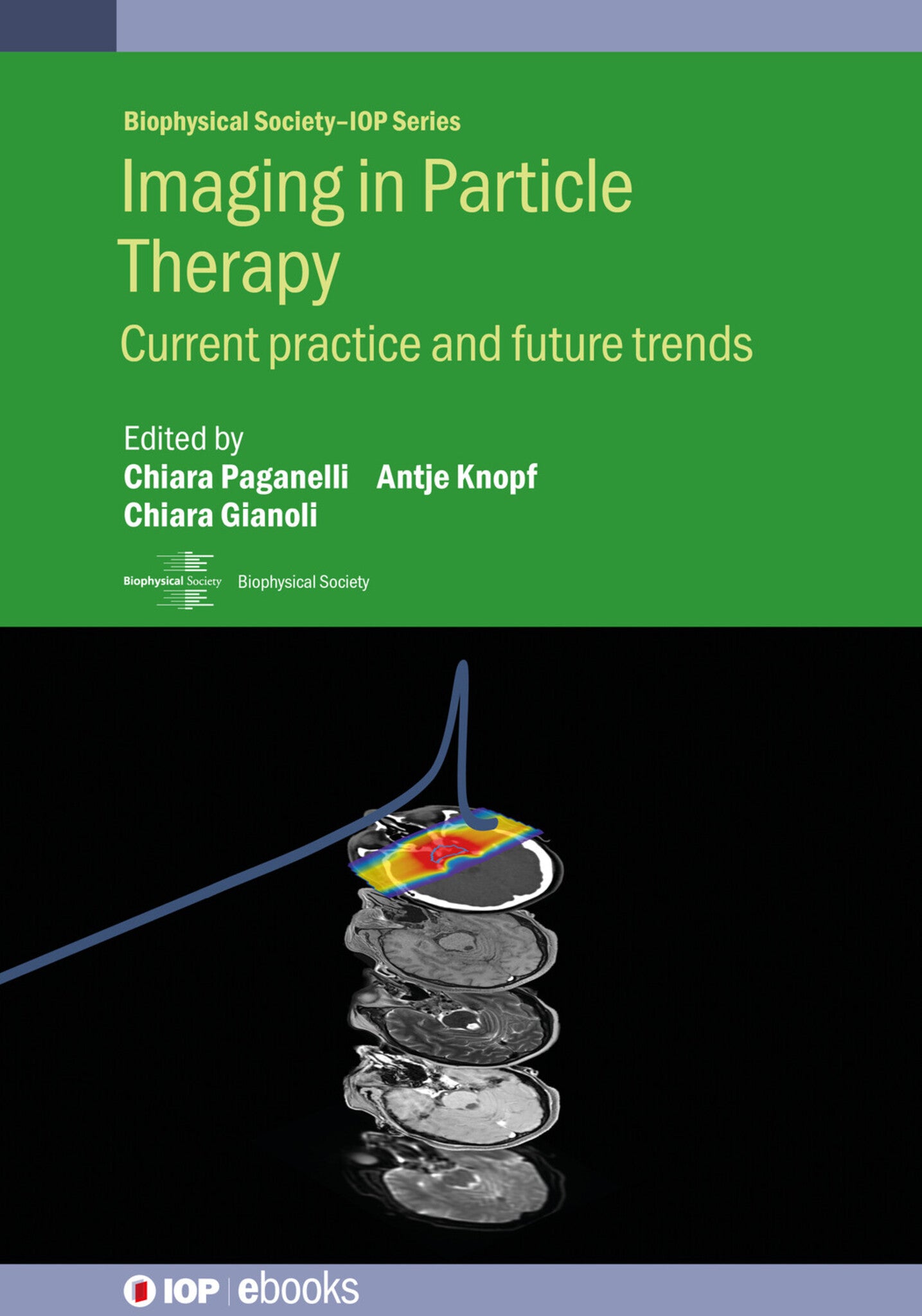 Imaging in Particle Therapy