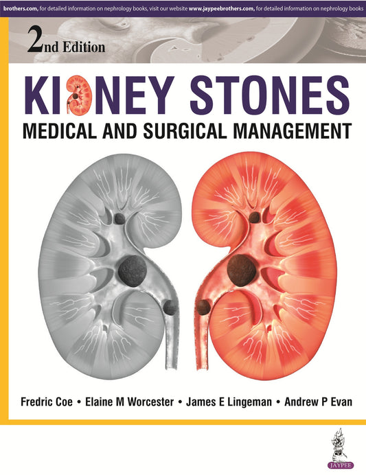 Kidney Stones