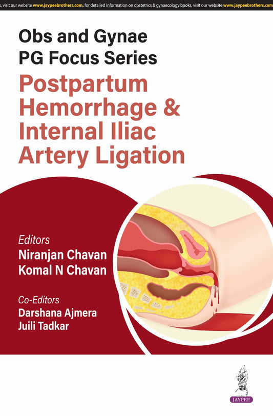 Obs and Gynae PG Focus Series: Postpartum Hemorrhage and Internal Iliac Artery Ligation