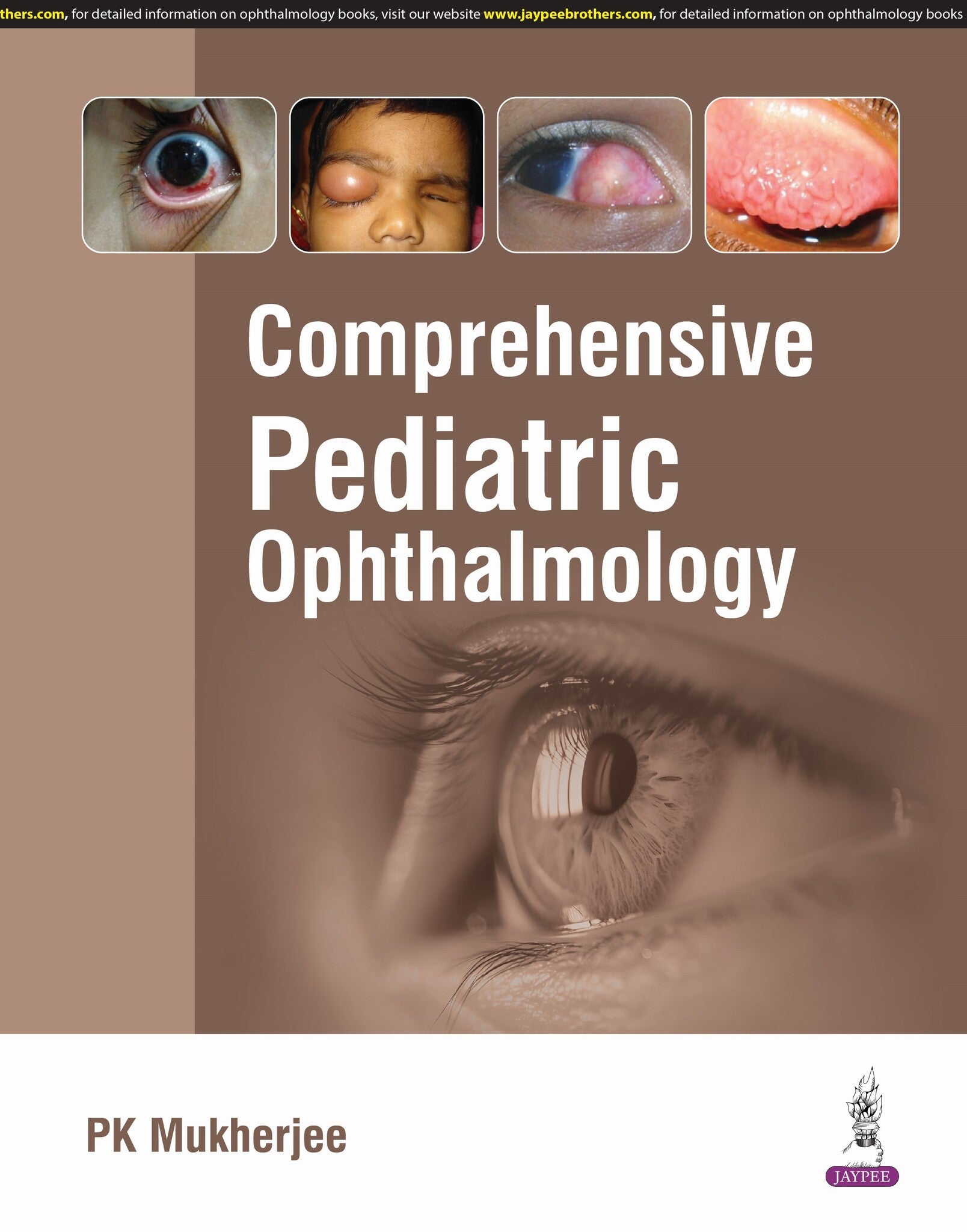 Comprehensive Pediatric Ophthalmology