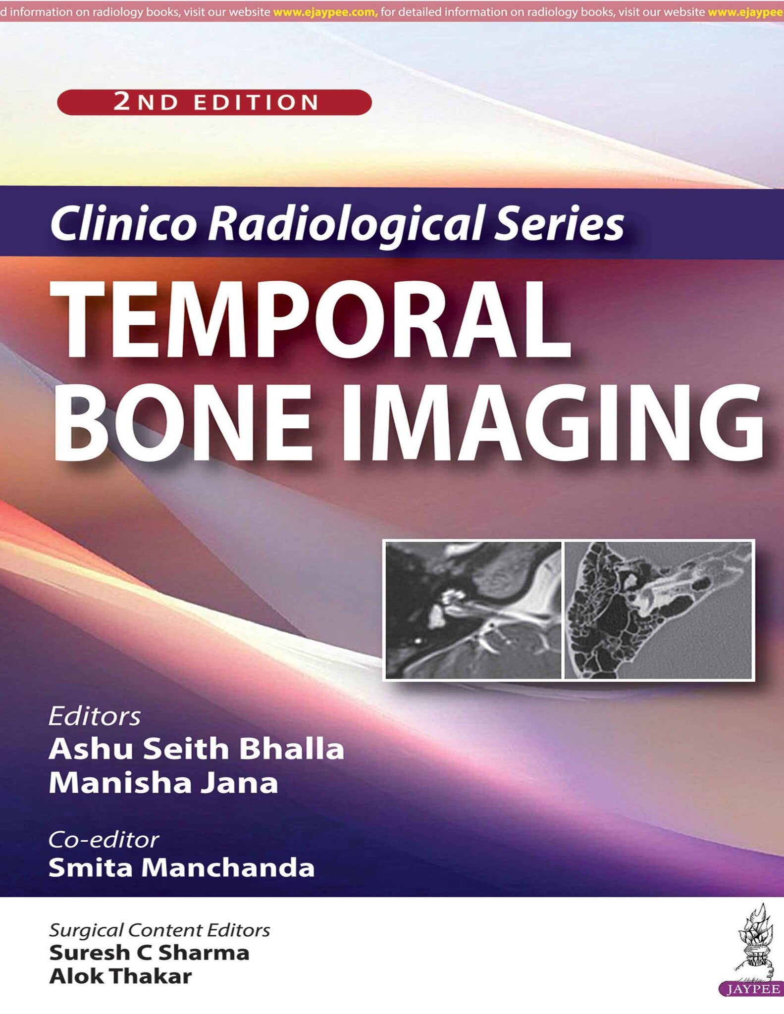 Clinico Radiological Series: Temporal Bone Imaging