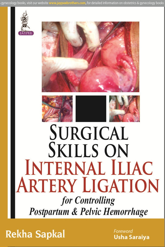 Surgical Skills on Internal Iliac Artery Ligation for Controlling  Postpartum and Pelvic Hemorrhage