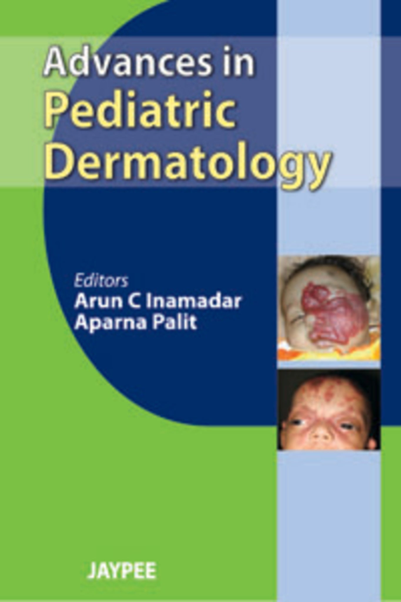 Advances in Pediatric Dermatology