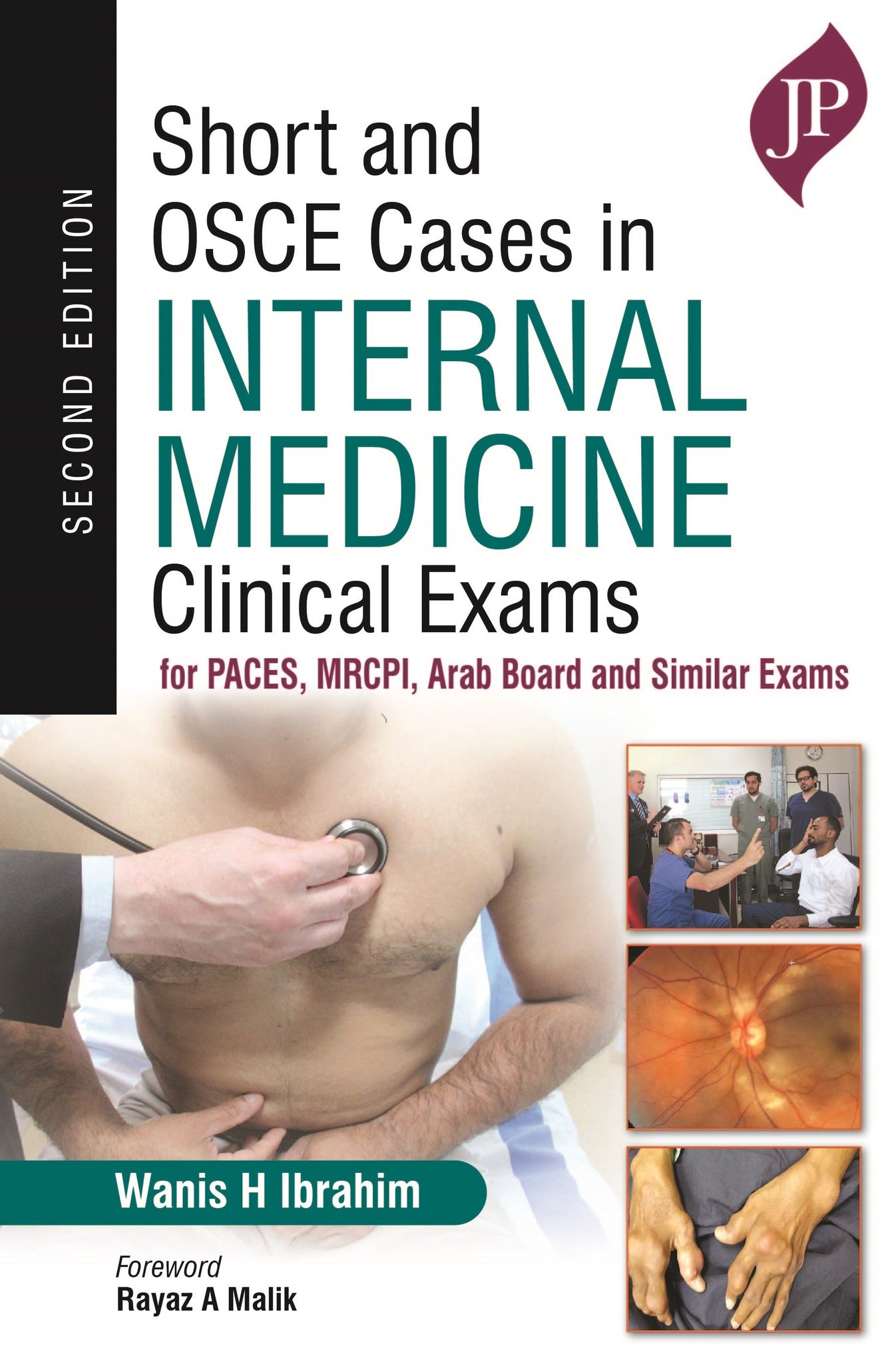 Short and OSCE Cases in Internal Medicine Clinical Exams