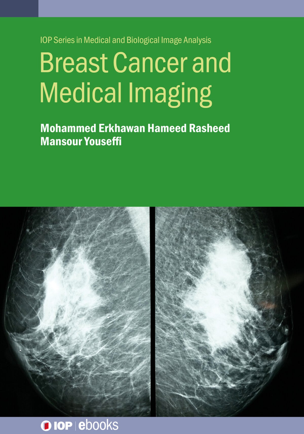 Cover image for Breast Cancer and Medical Imaging ISBN 9780750357074