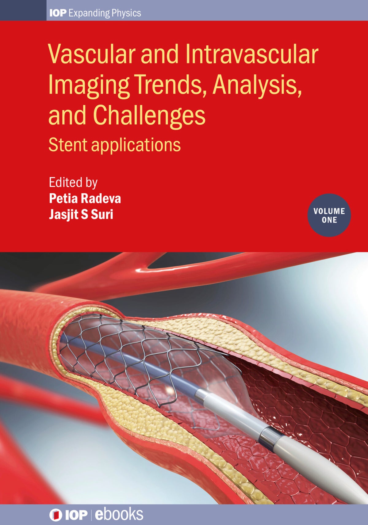 Cover image for Vascular and Intravascular Imaging Trends, Analysis, and Challenges, Volume 1 ISBN 9780750319973