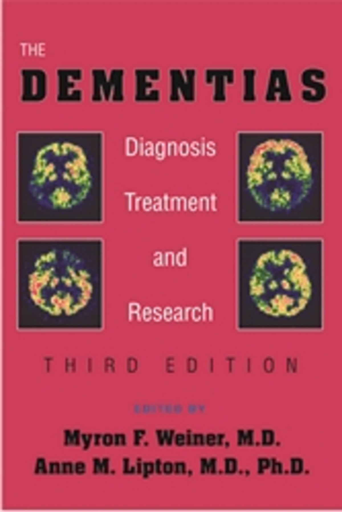 The Dementias