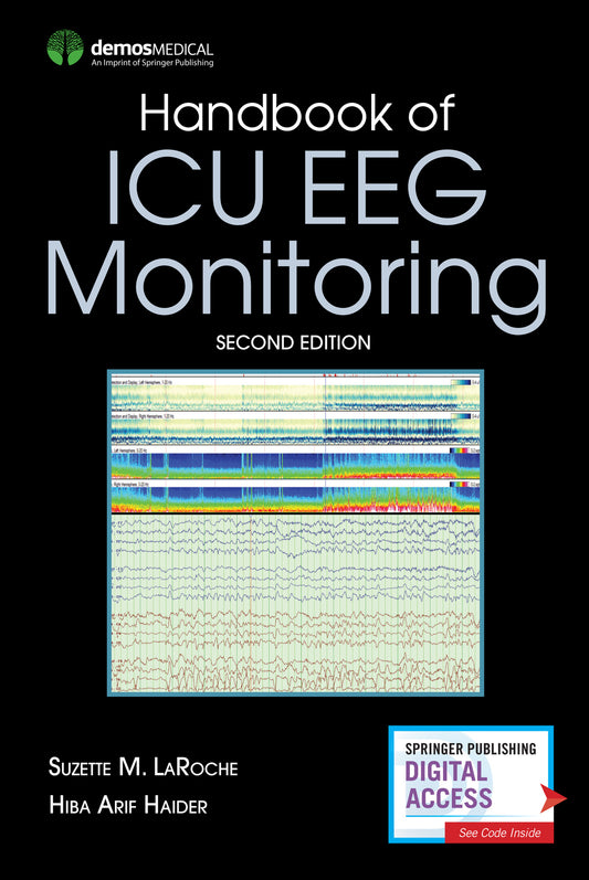 Handbook of ICU EEG Monitoring