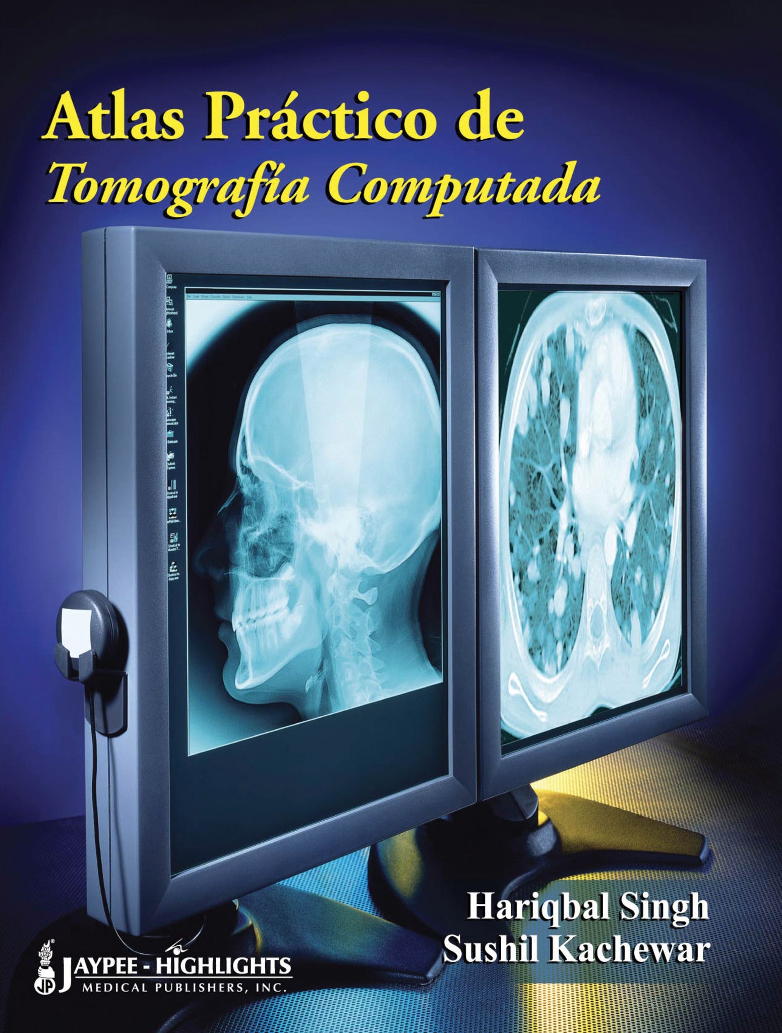 Atlas Práctico de Tomografia Computada