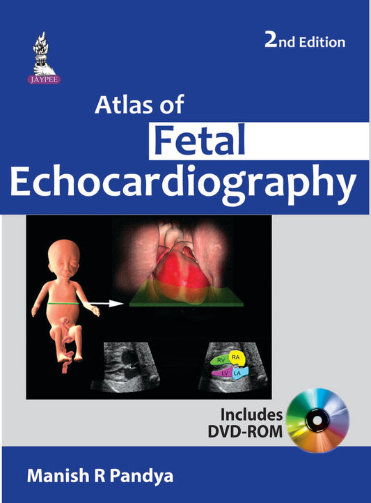 Atlas of Fetal Echocardiography