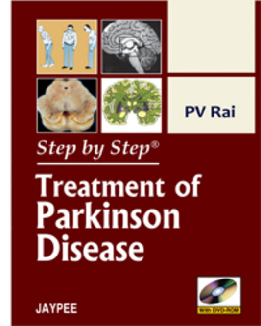 Step by Step: Treatment of Parkinson Disease