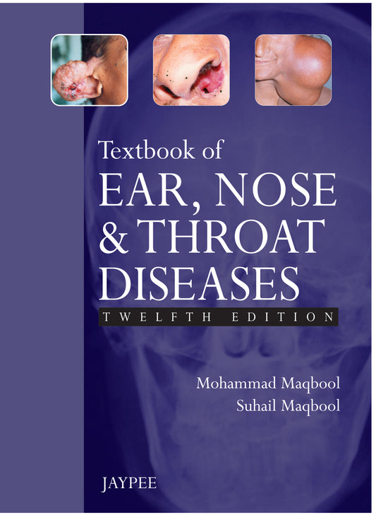 Textbook of Ear, Nose and Throat Diseases