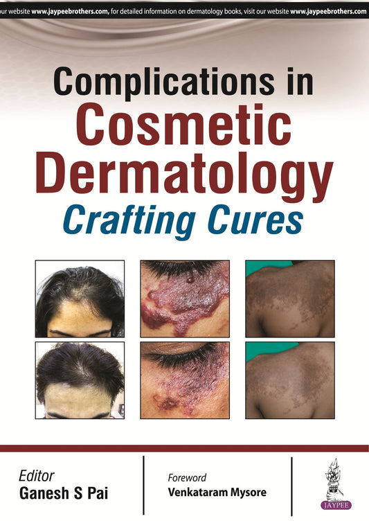 Complications in Cosmetic Dermatology
