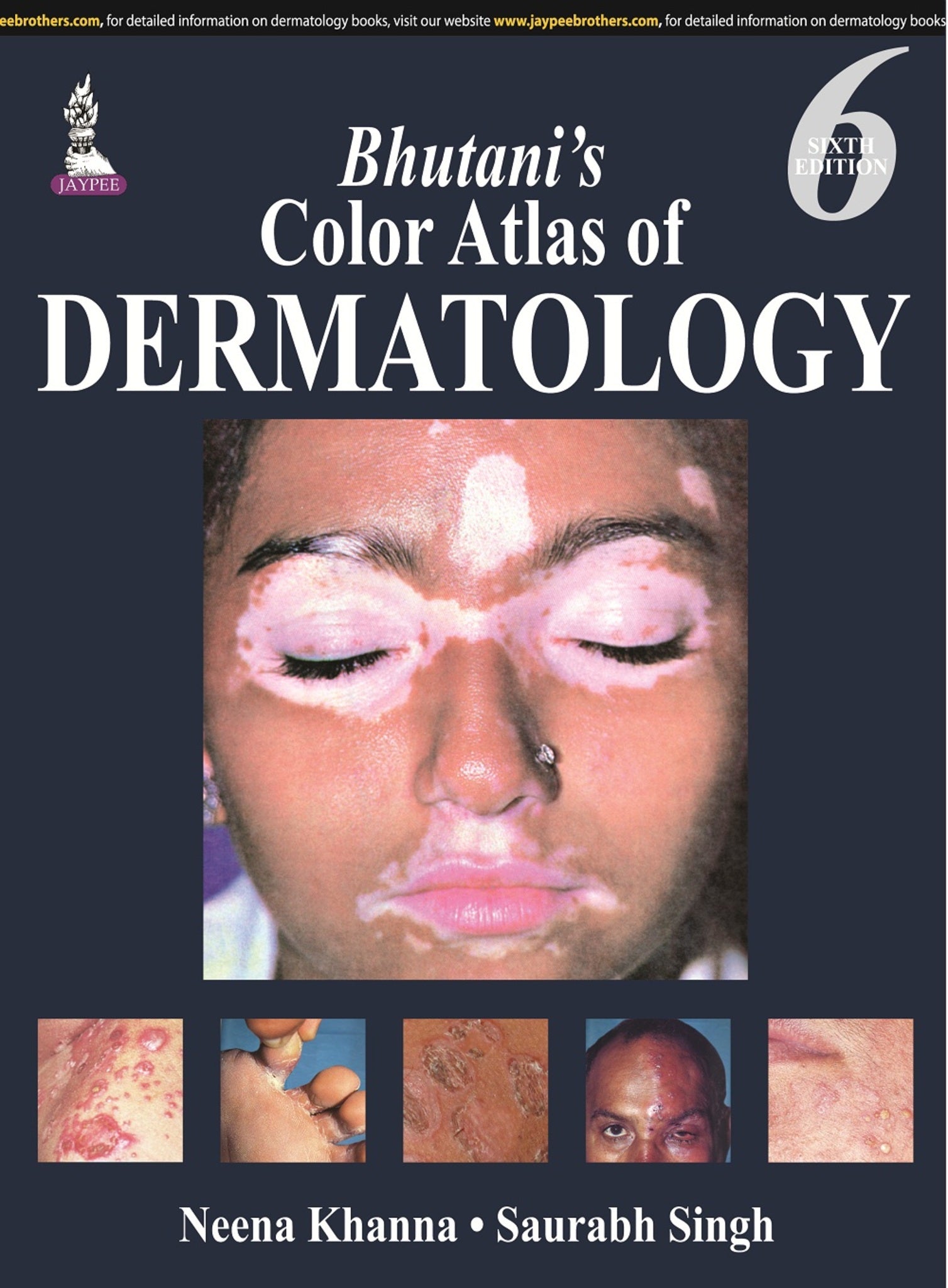 Bhutani’s  Color Atlas of Dermatology