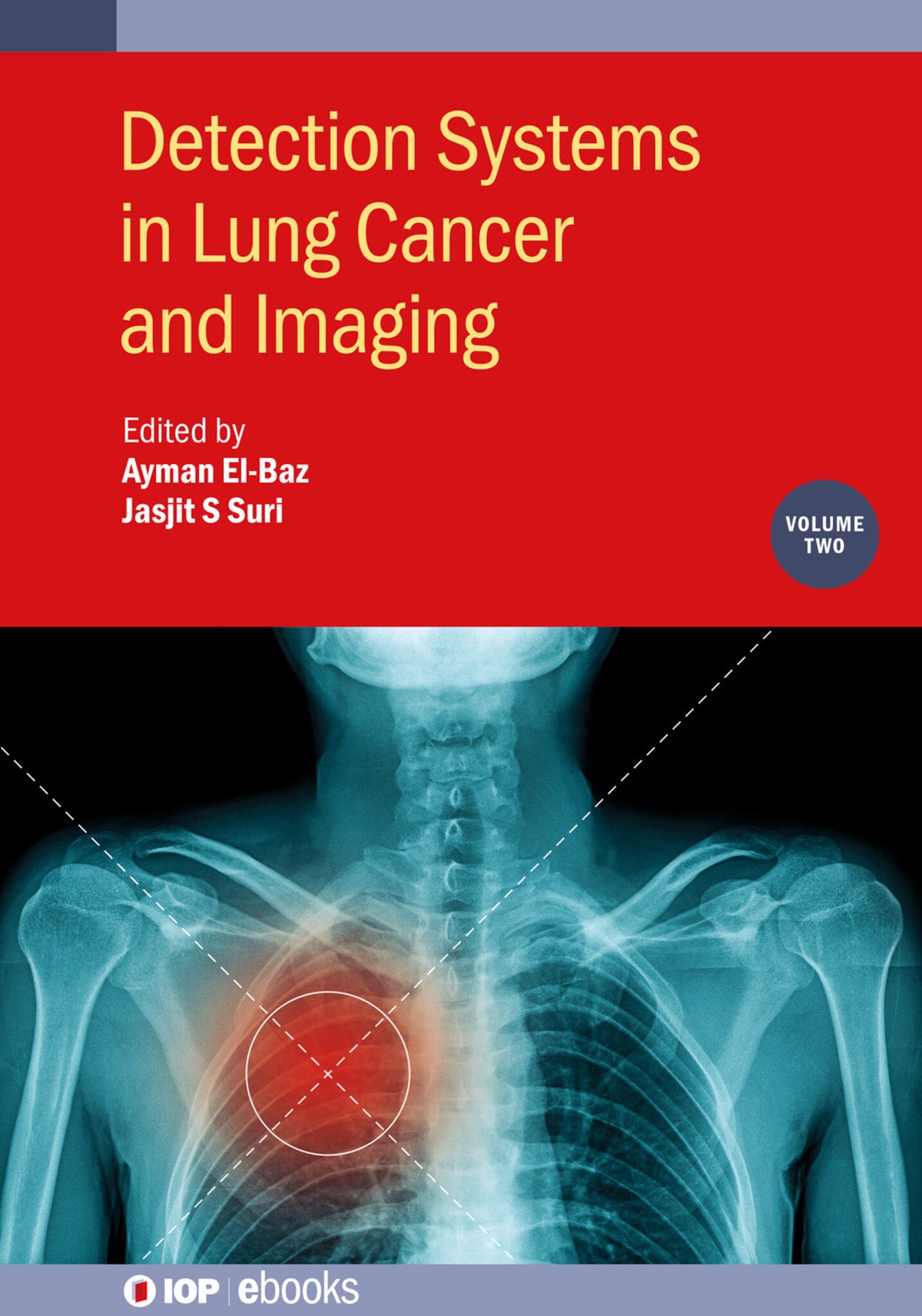 Cover image for Detection Systems in Lung Cancer and Imaging, Volume 2 ISBN 9780750333597