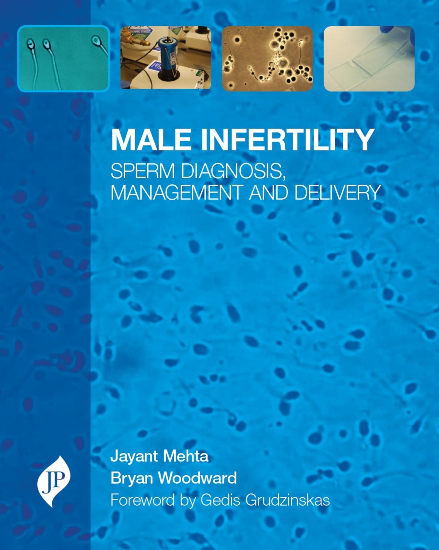 Male Infertility