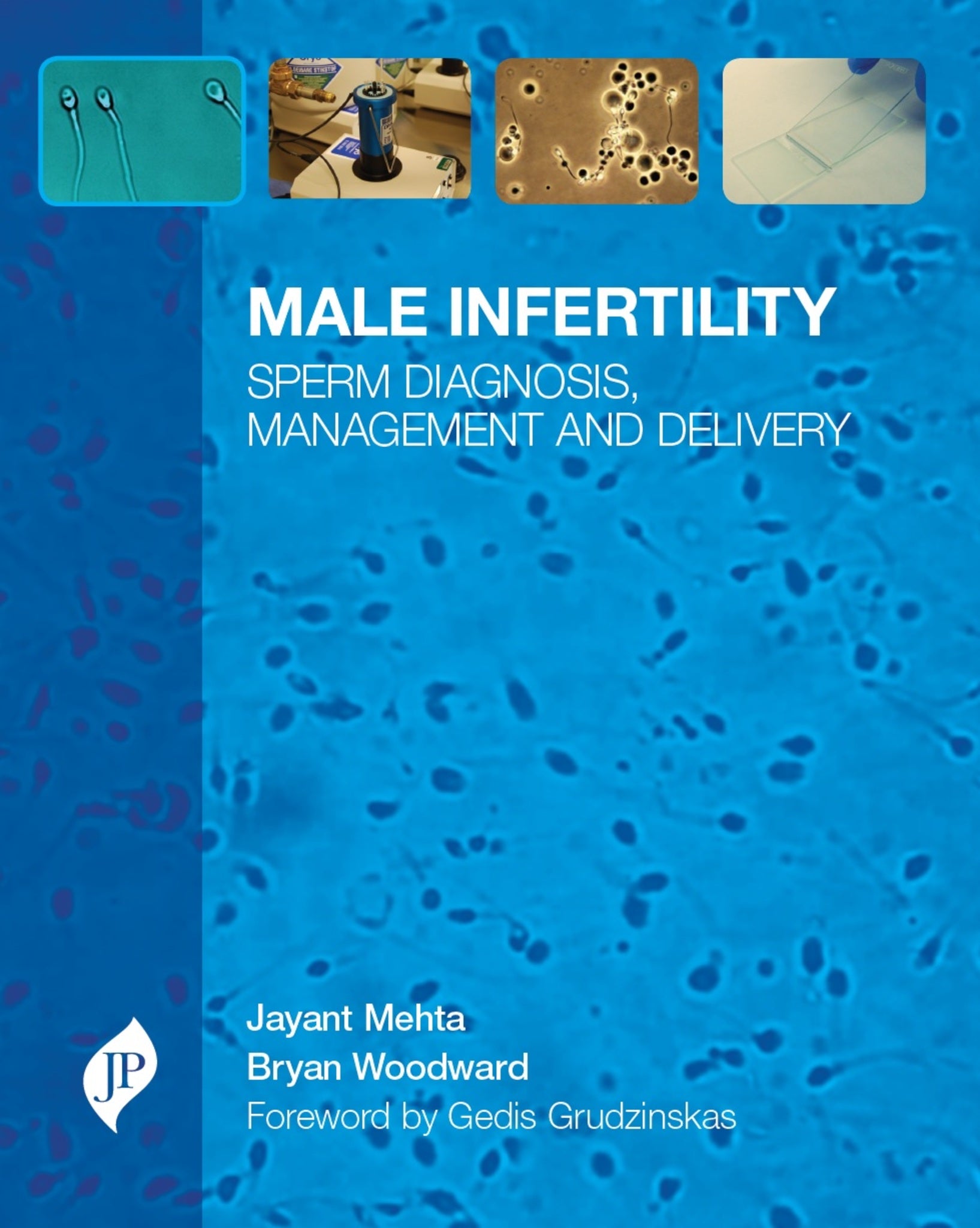 Male Infertility