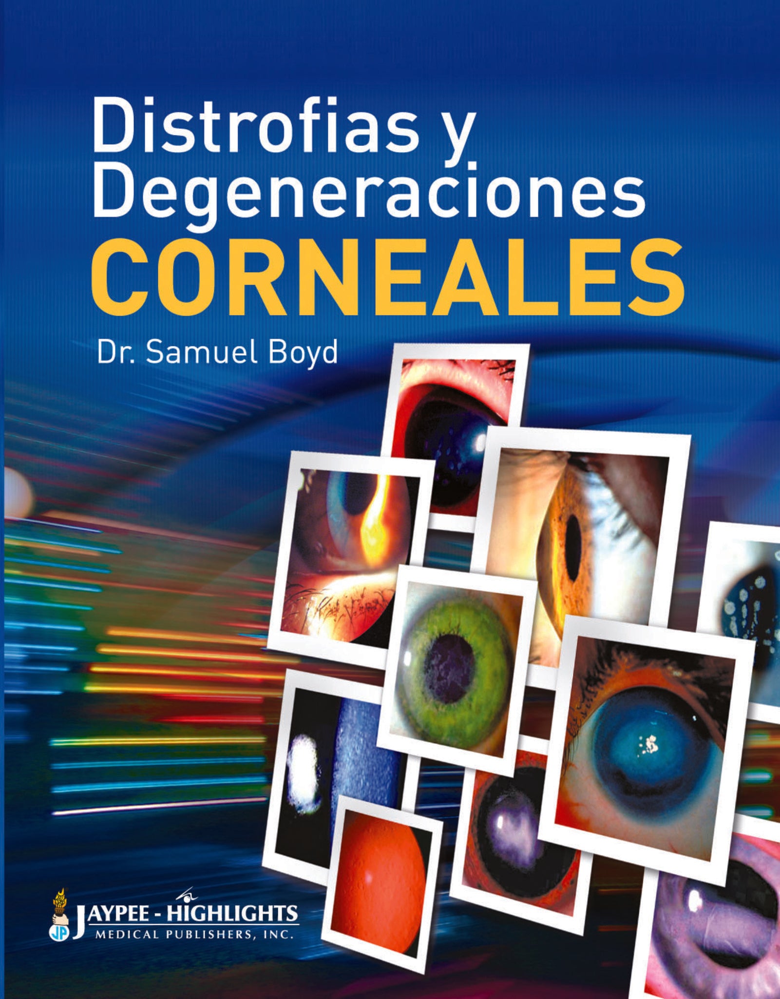 Distrofías y Degeneraciones Corneales