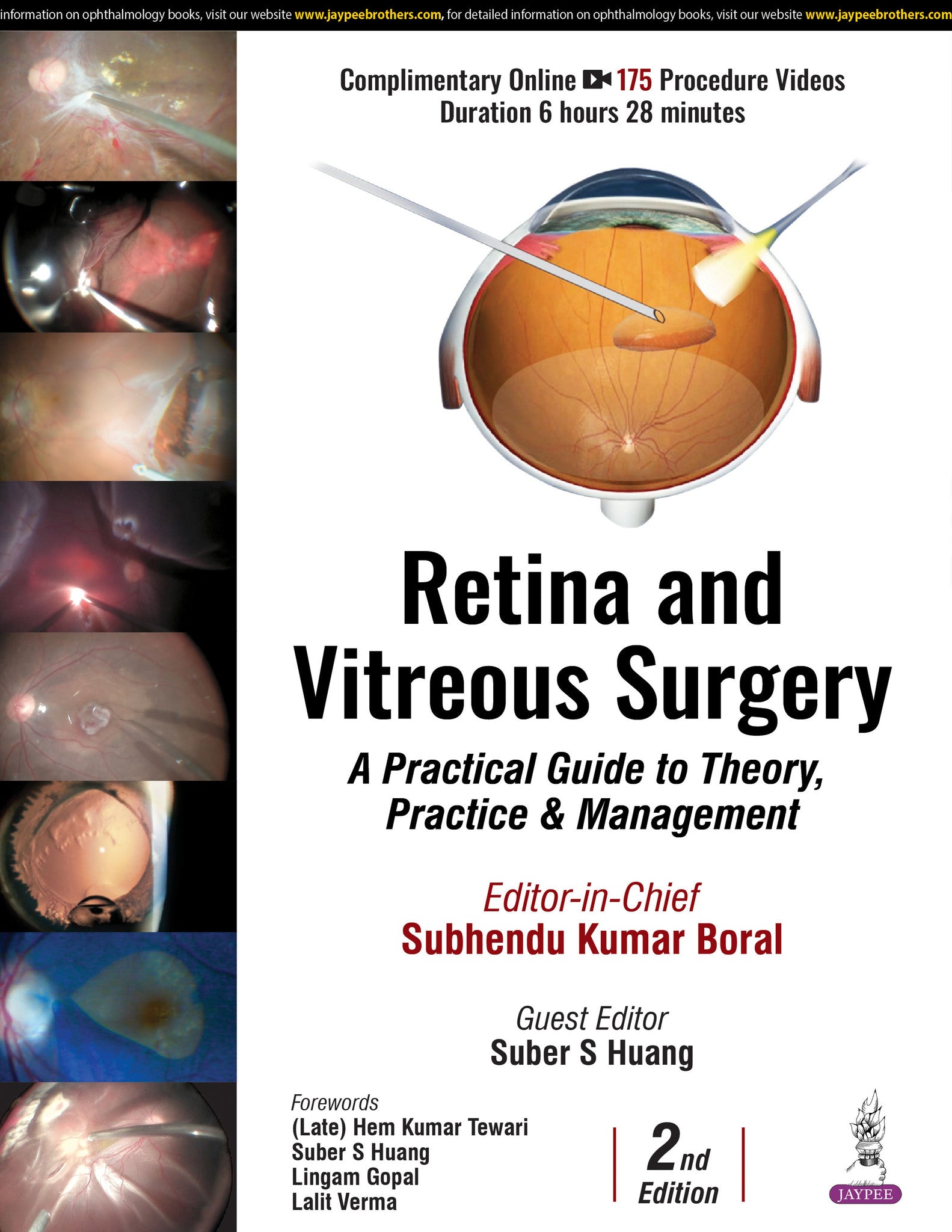 Retina and Vitreous Surgery
