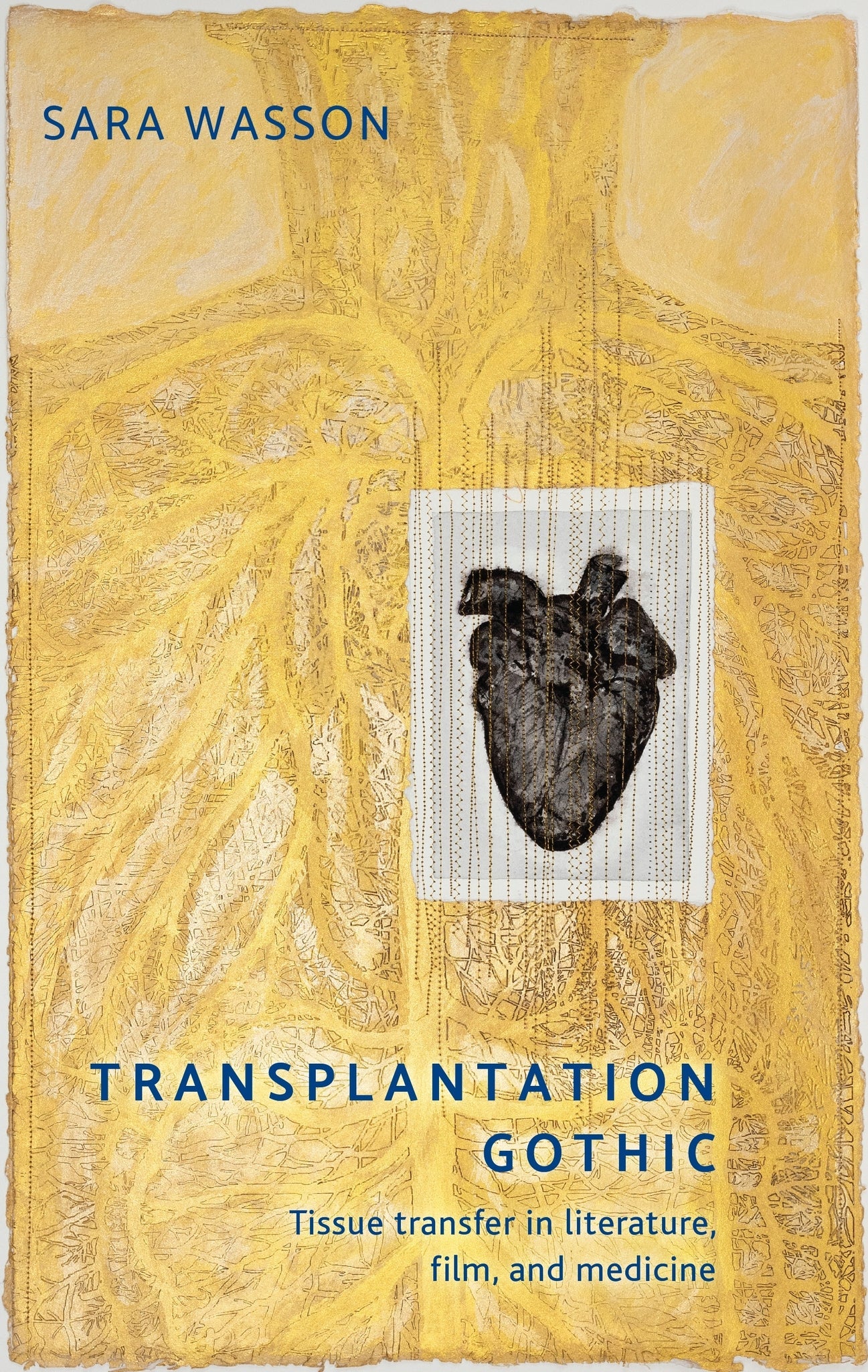 Cover image for Transplantation Gothic ISBN 9781526171719