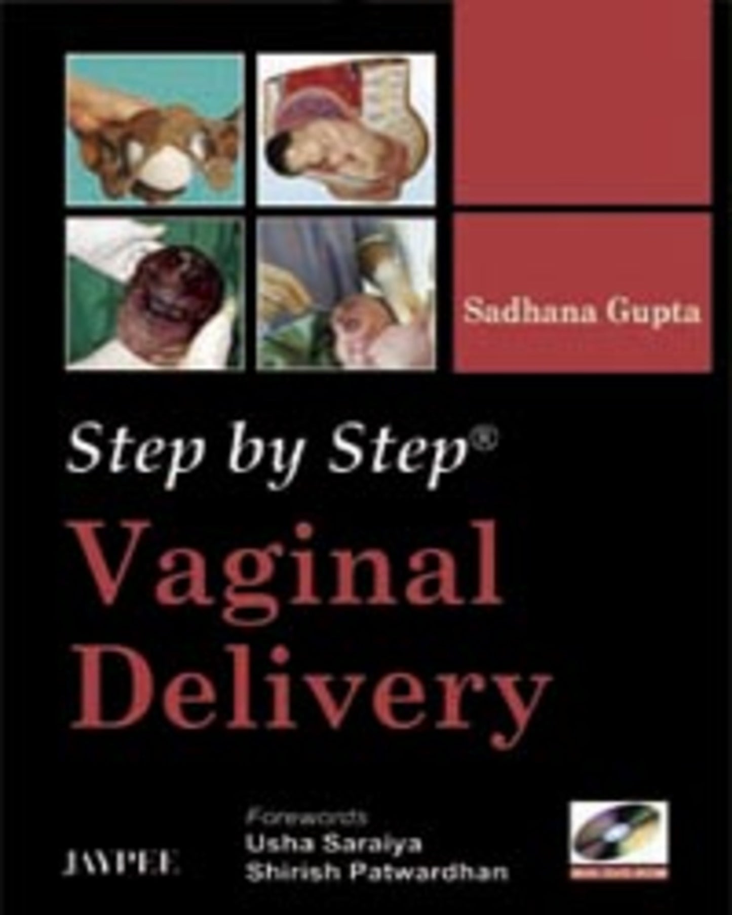 Step by Step: Vaginal Delivery