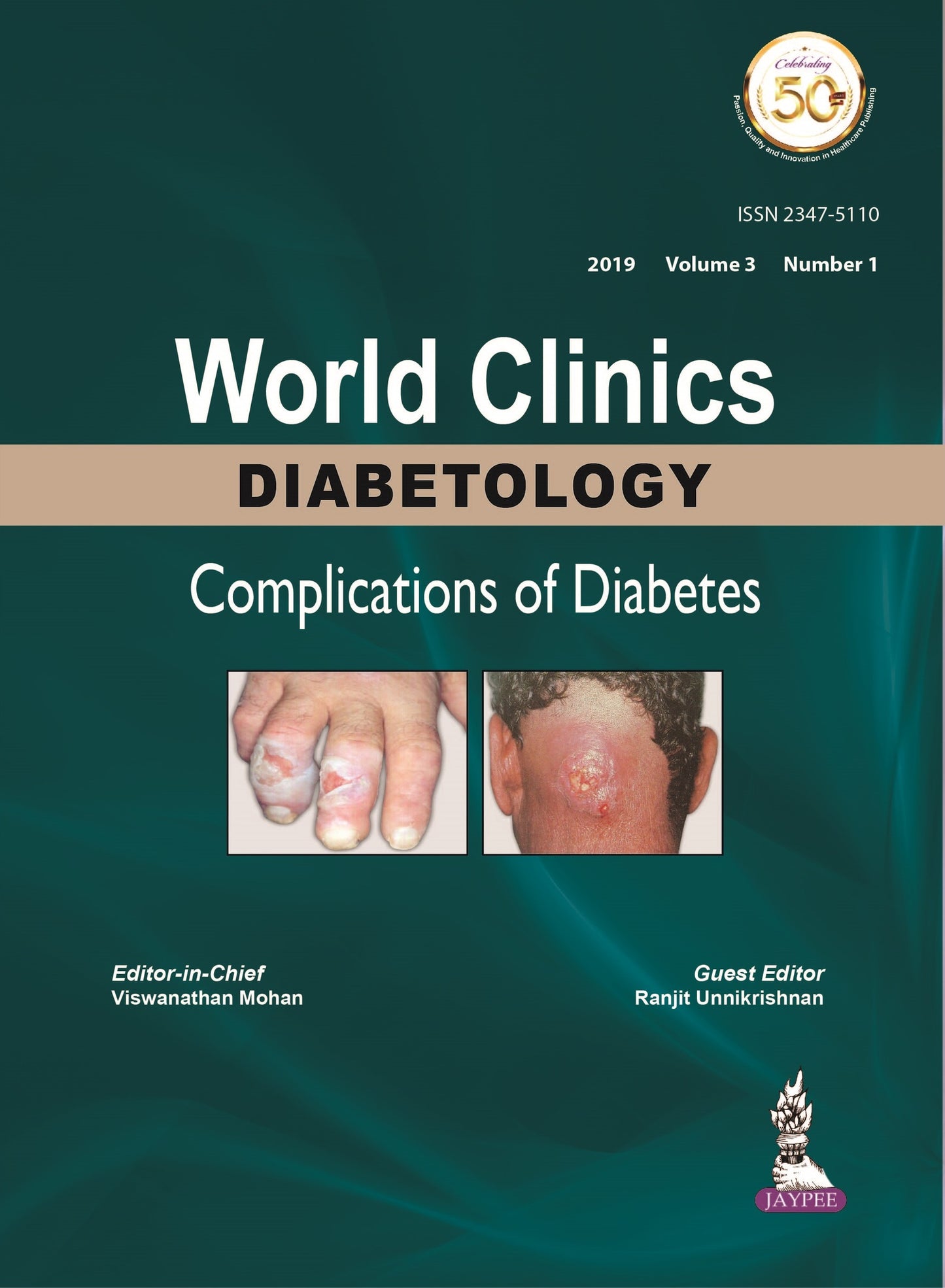 World Clinics Diabetology: Complications of Diabetes