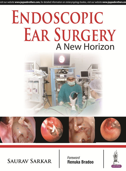Endoscopic Ear Surgery