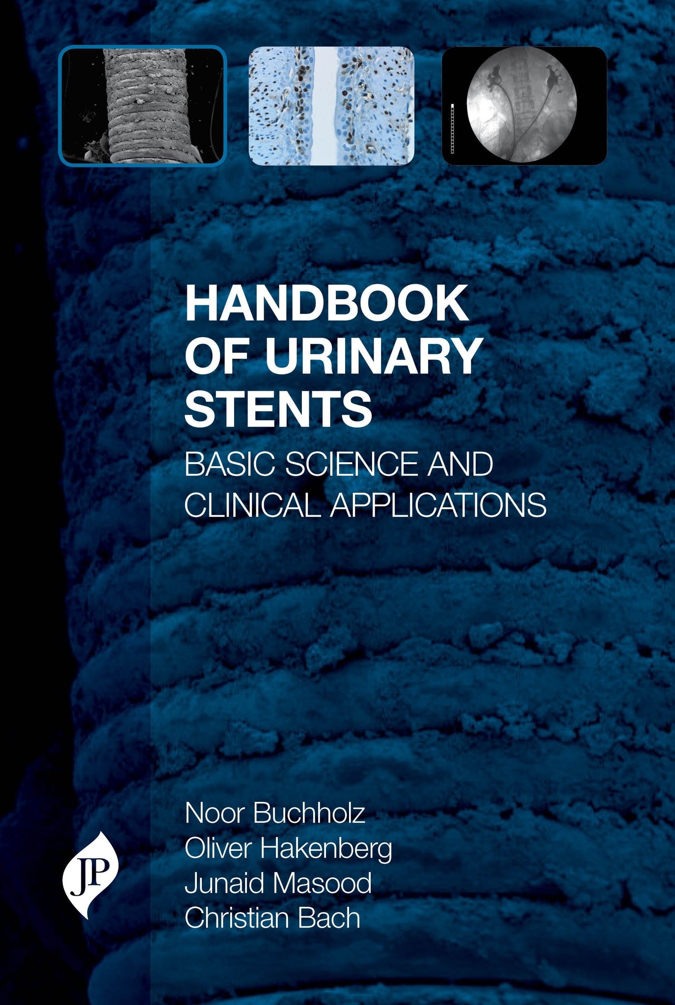 Handbook of Urinary Stents