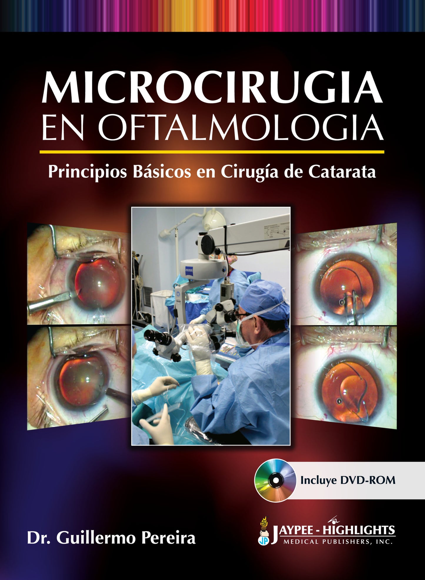 Microcirugía en Oftalmología: Principios Básicos en Cirugía de Catarata