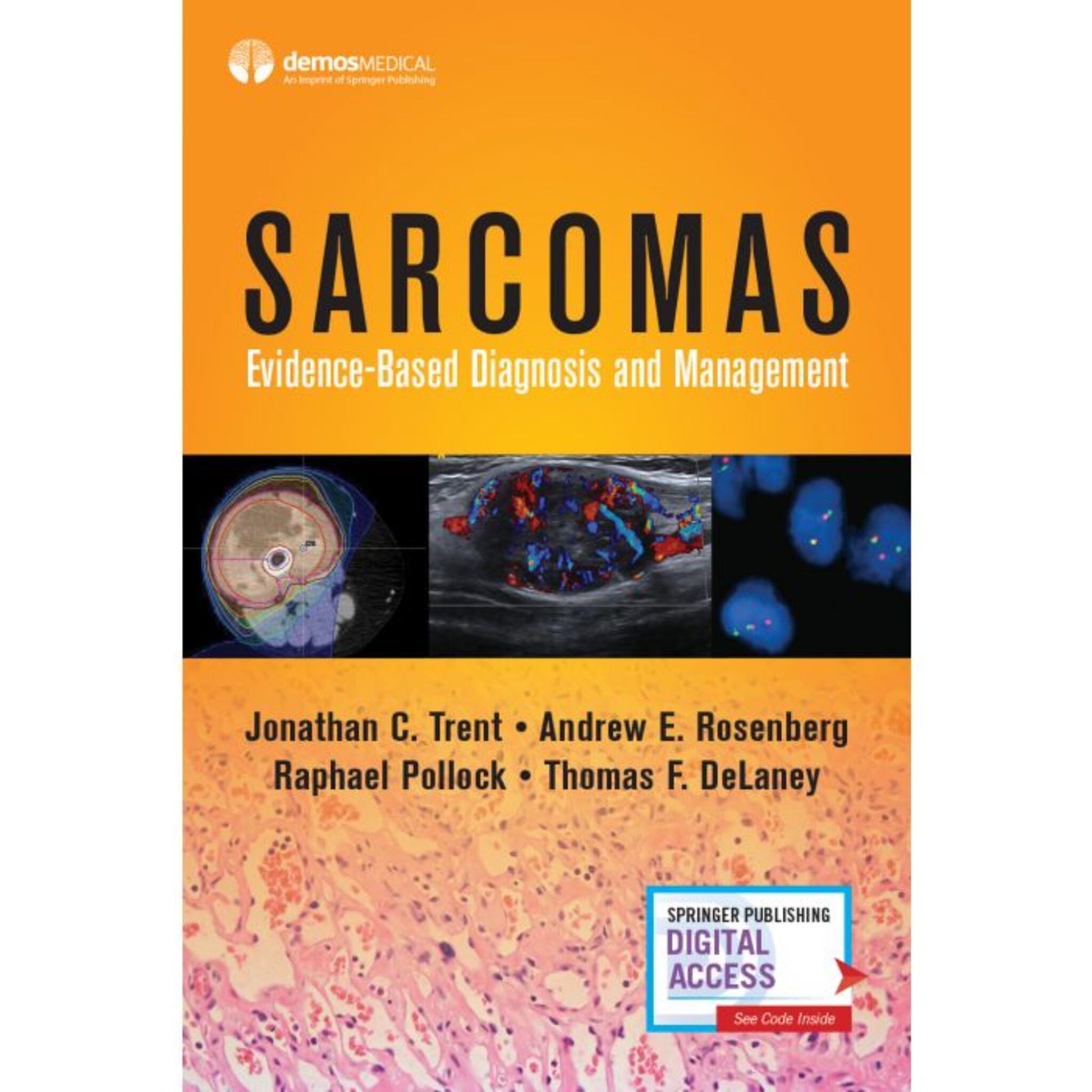 Sarcomas