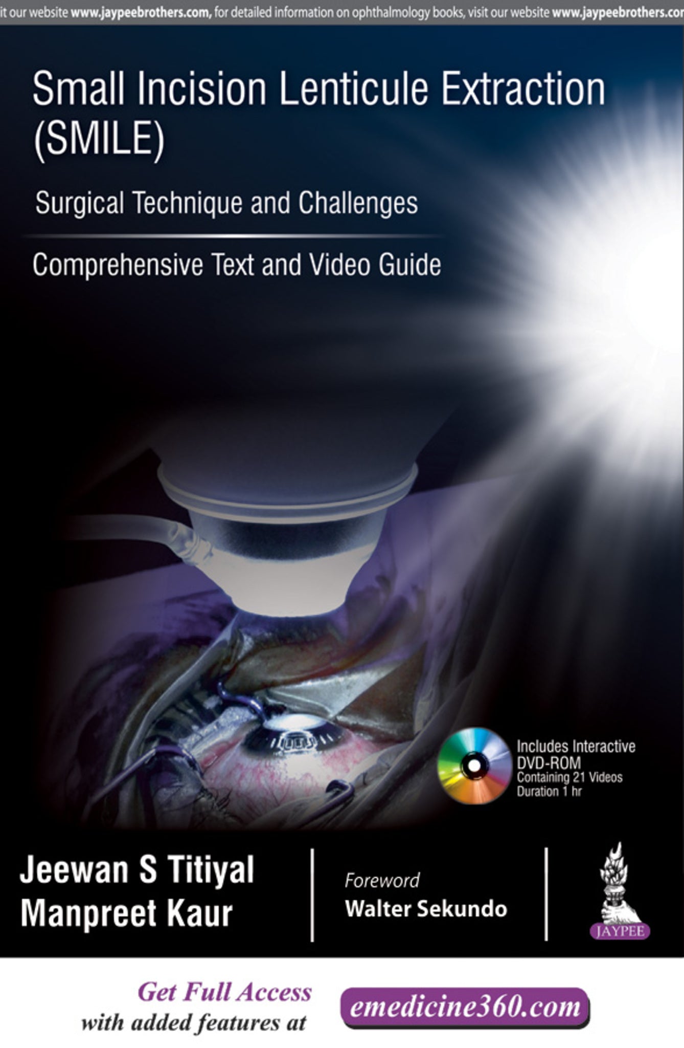 Small Incision Lenticule Extraction (SMILE): Surgical Technique and Challenges