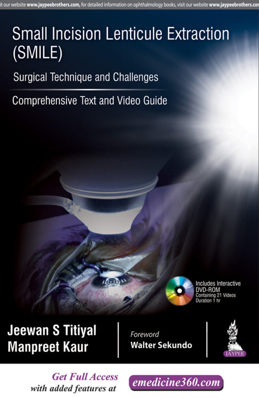 Small Incision Lenticule Extraction (SMILE): Surgical Technique and Challenges