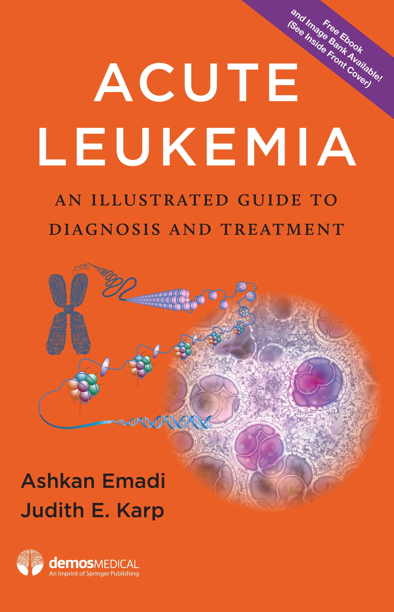 Acute Leukemia