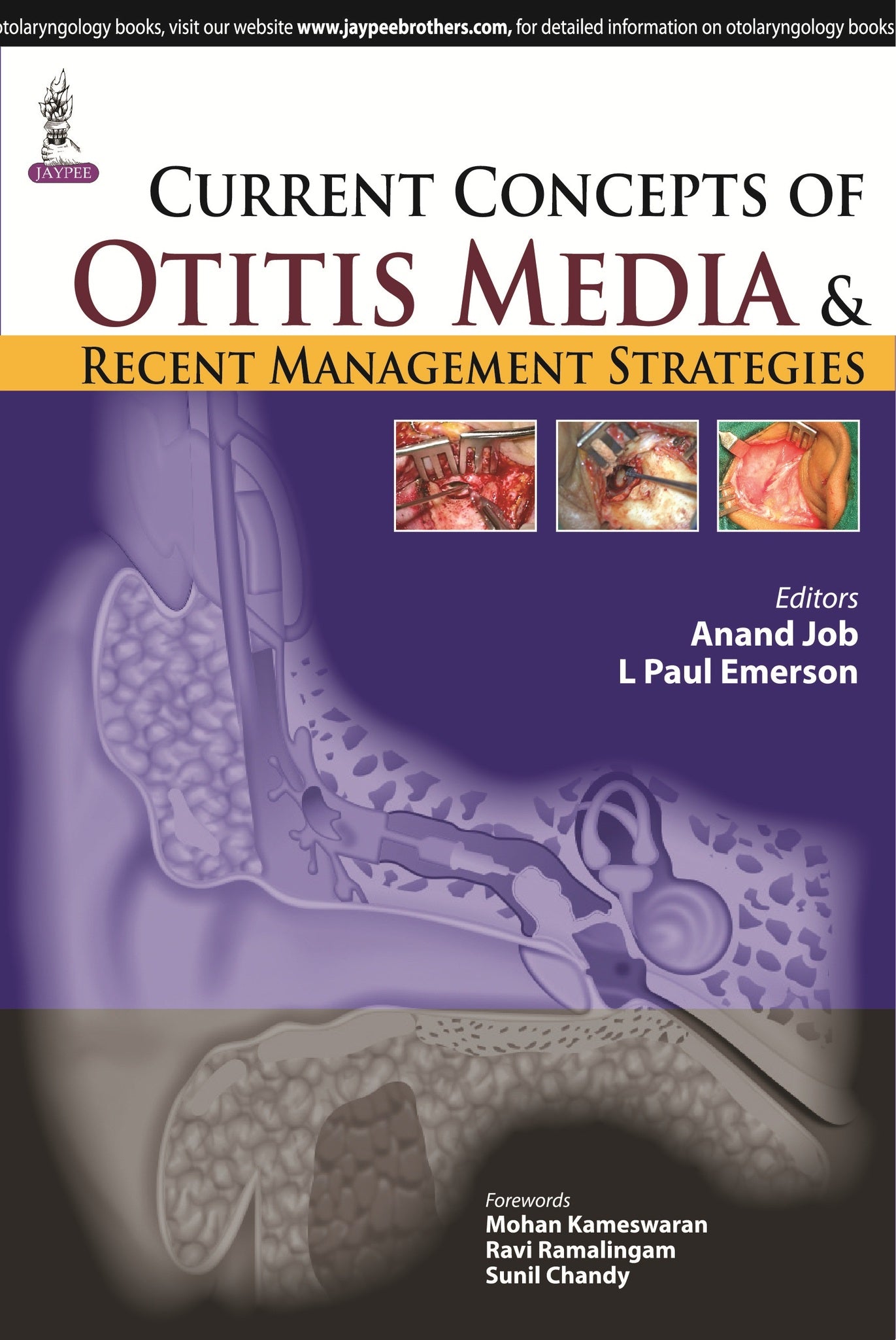 Current Concepts of Otitis Media and Recent Management Strategies